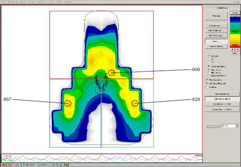 プレッシャーアナリシスツール